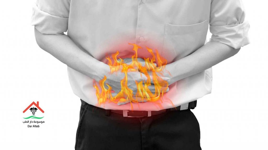 علاج الحموضة بالاعشاب