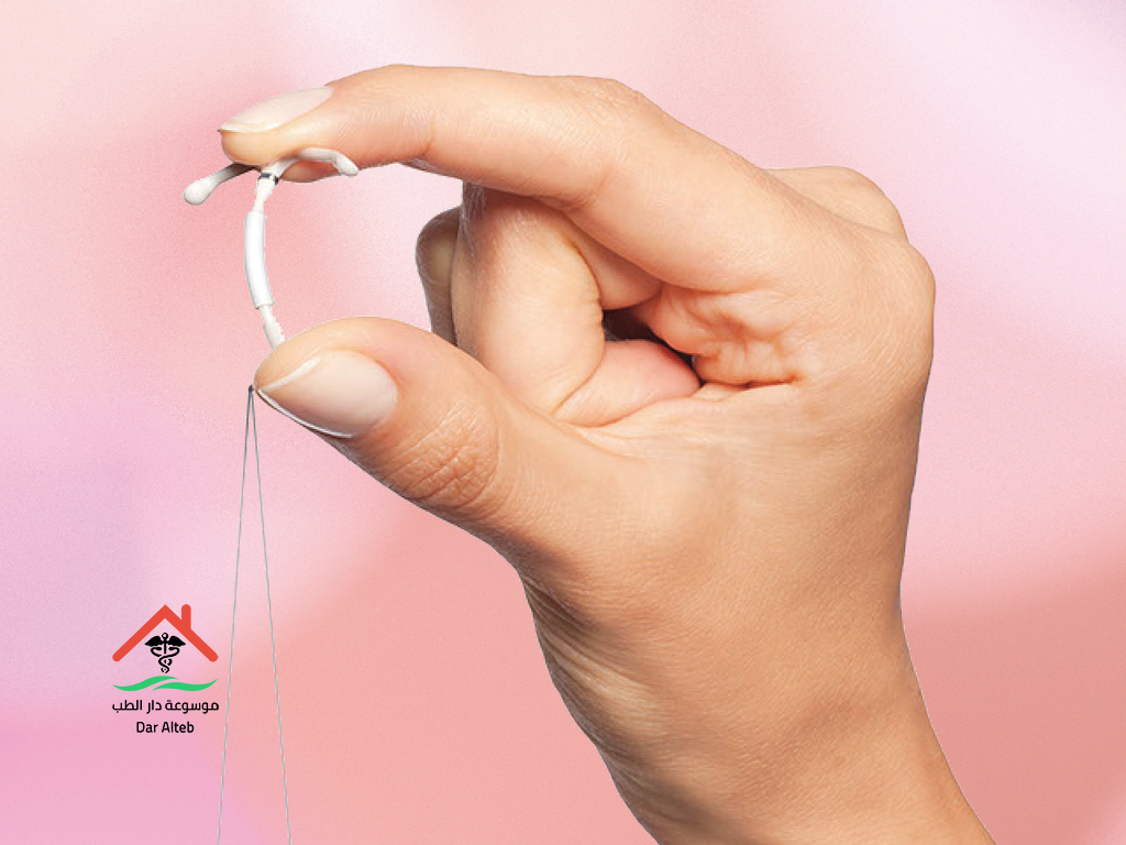 اللولب طريقة وضعه واضراره