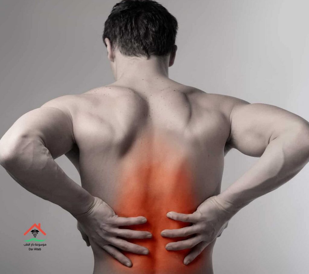 التهاب عضلات الظهر أسبابه وعلاجه