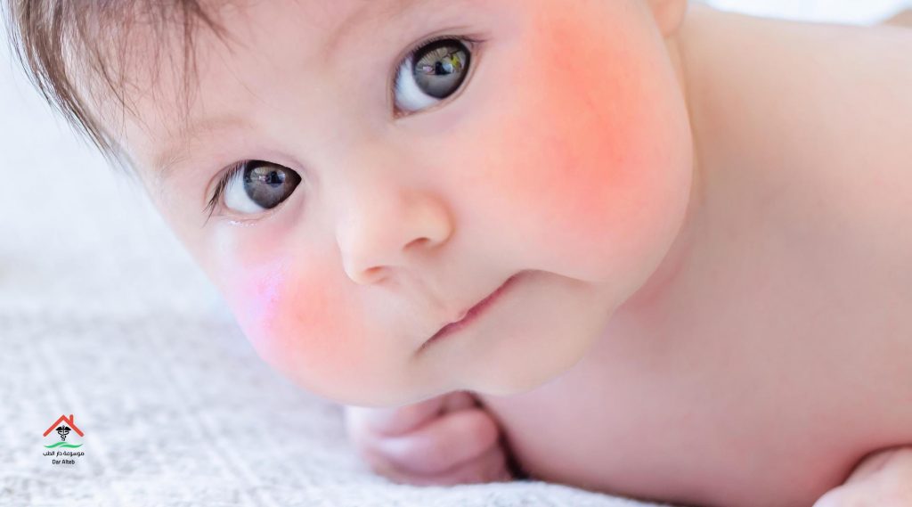 علاج السخونة عند الاطفال