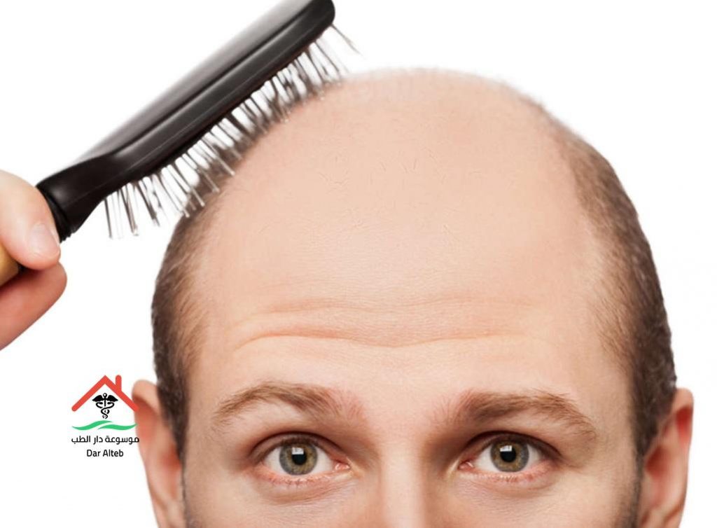 افضل علاج للصلع مجرب