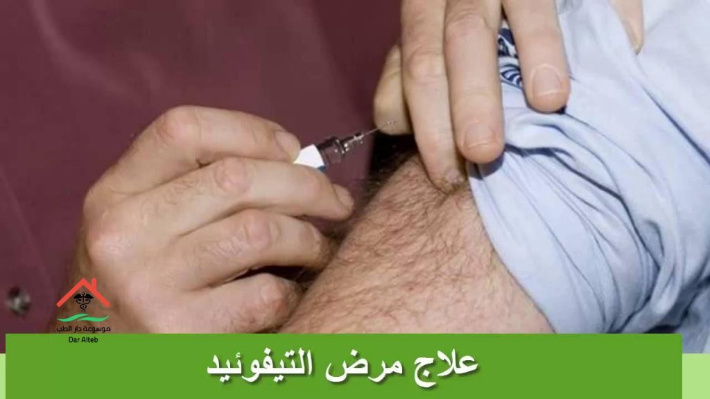 مرض التيفود اسبابه اعراضه وعلاجه