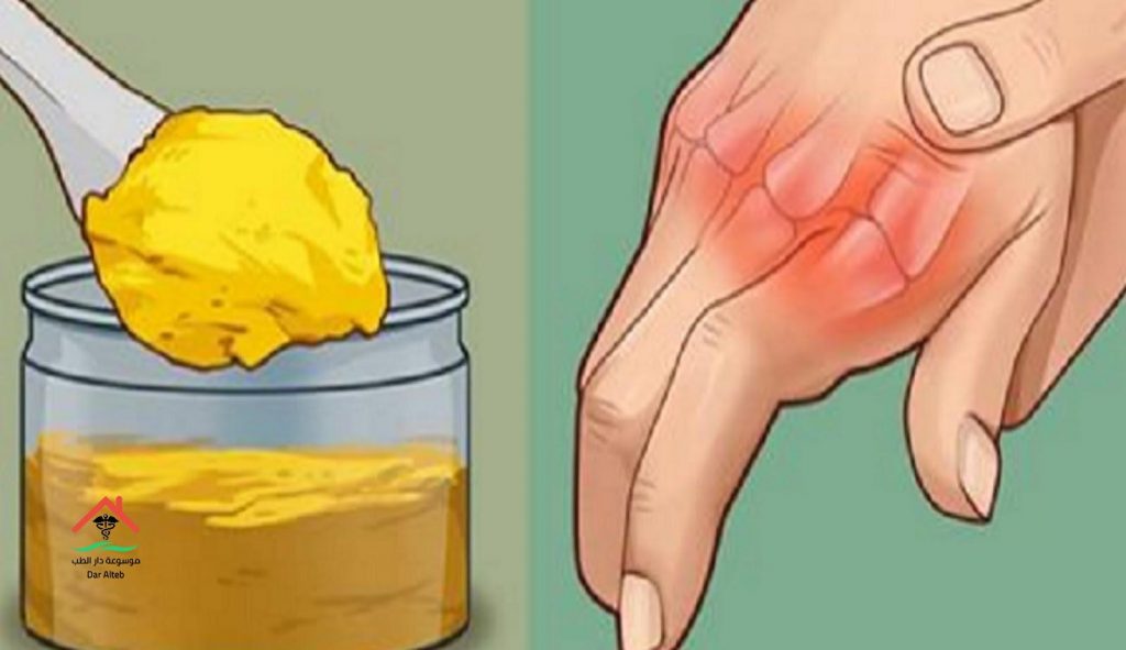 طرق علاج التهاب المفاصل بالأعشاب