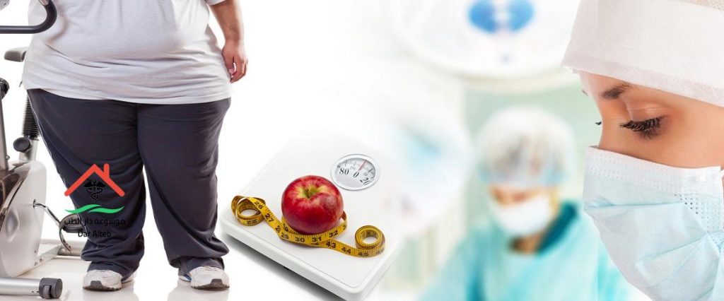 أنواع جراحات السمنة