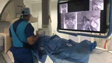 Photo of كيف أختار أفضل دكتور تردد حرارى في مصر؟